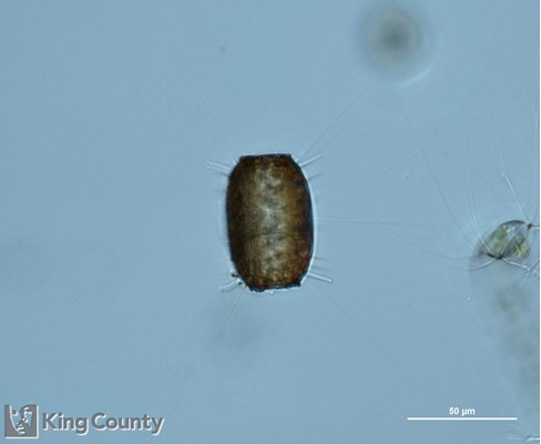 Photo of Thalassiosira punctigera